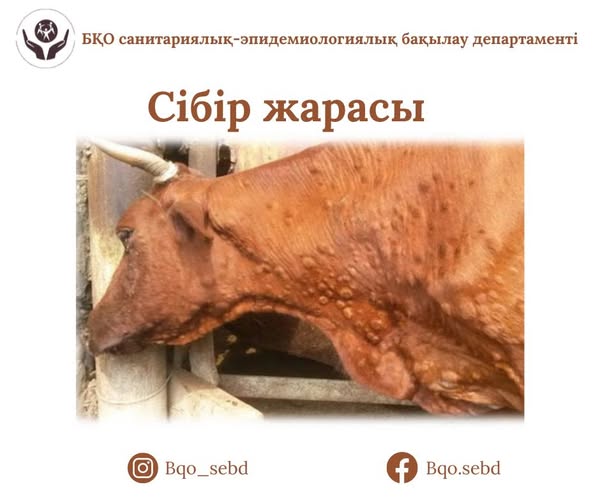 Сібір жарасының алдын алу