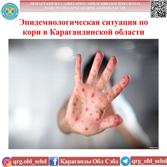 Қарағанды облысындағы қызылша бойынша эпидемиологиялық жағдай