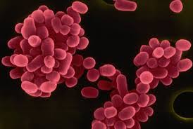 ⚜️Бруцеллездің алдын алу туралы