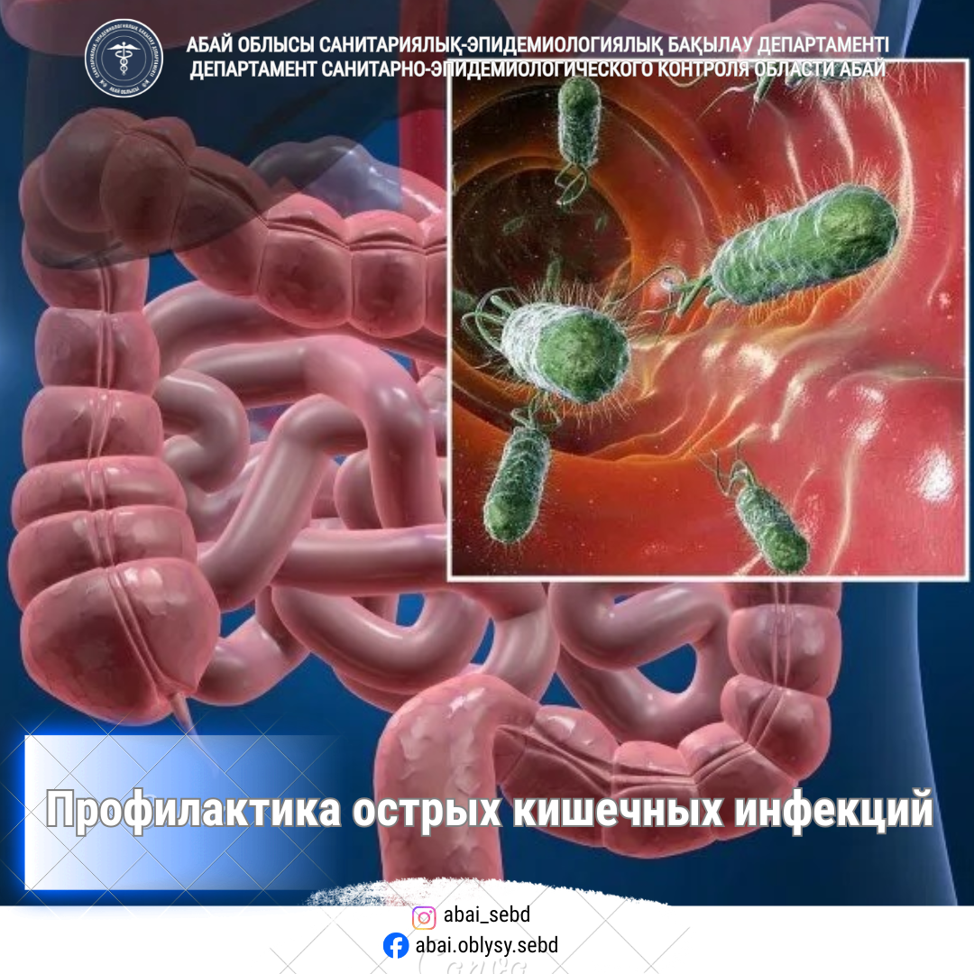 Жіті ішек инфекцияларының алдын алу