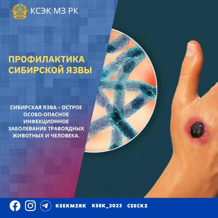 Сібір жарасының алдын алу